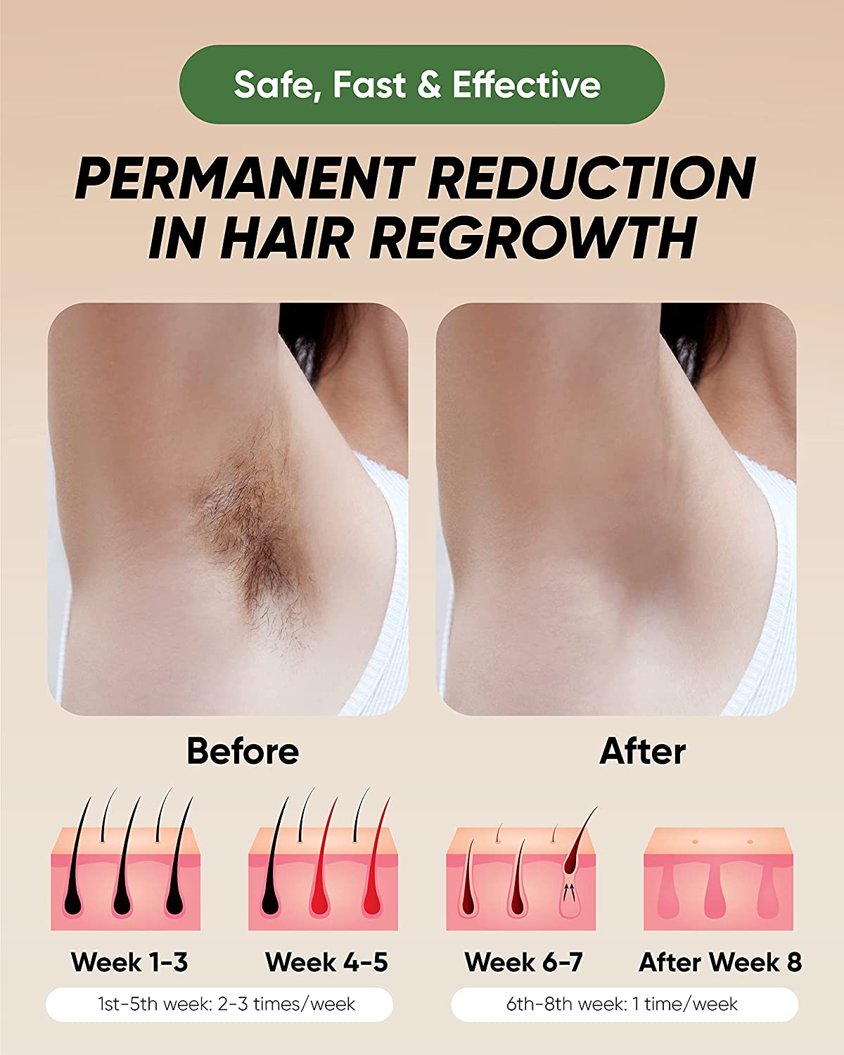 XSOUL At-Home IPL Hair Removal for Women and Men Permanent Hair Removal 999,999 Flashes Painless Hair Remover on Armpits Back Legs Arms Face Bikini Line, Corded - Image 5